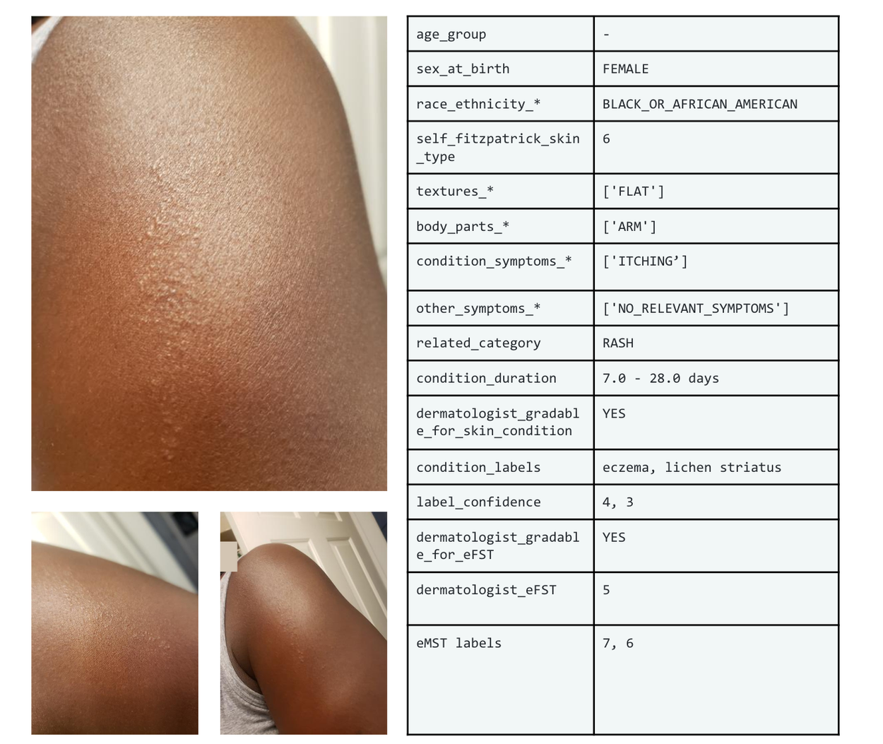 SCIN: A new resource for representative dermatology images