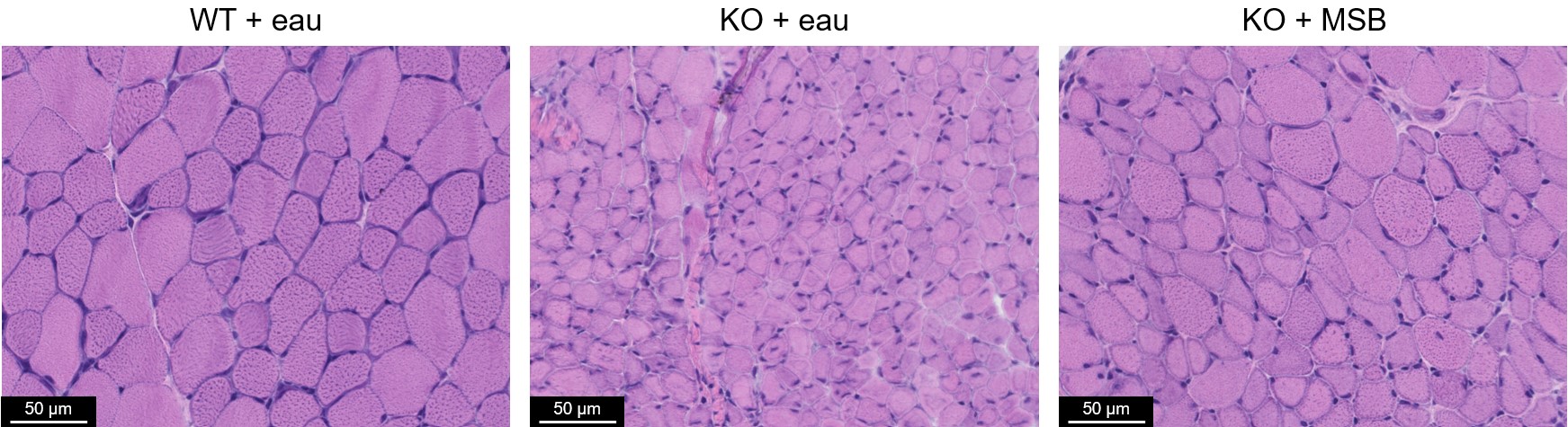 Une lueur d'espoir dans la myopathie : une supplémentation en vitamine ouvre des voies