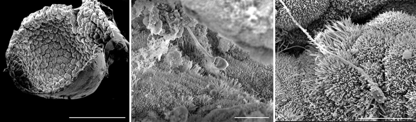 Avancée majeure en PMA : des organoïdes humains de trompes de Fallope cultivés in vitro