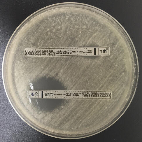 Antifongiques et antibiotiques : la résistance à double tranchant