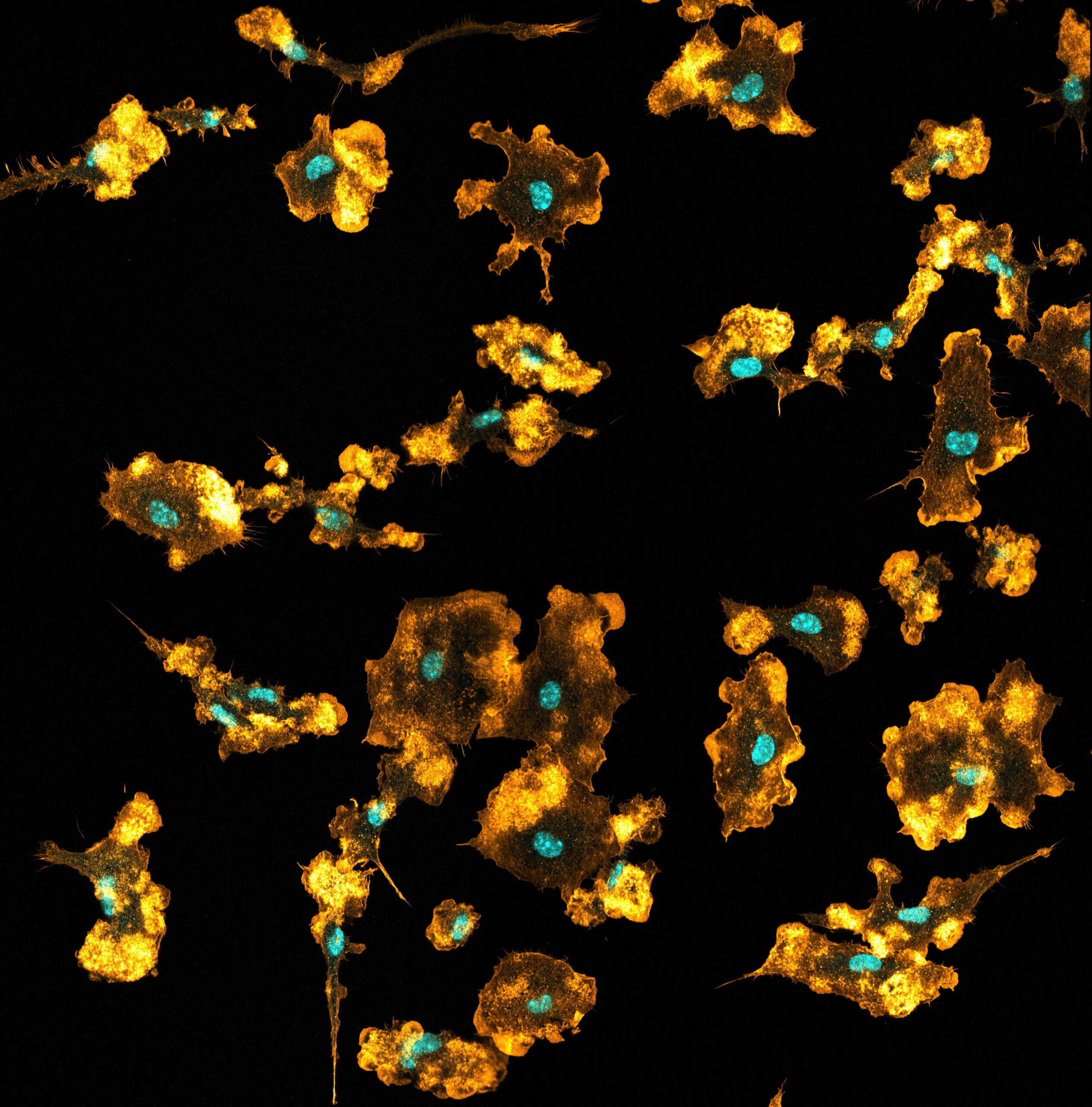 Les macrophages, ces fins gourmets de l’immunité