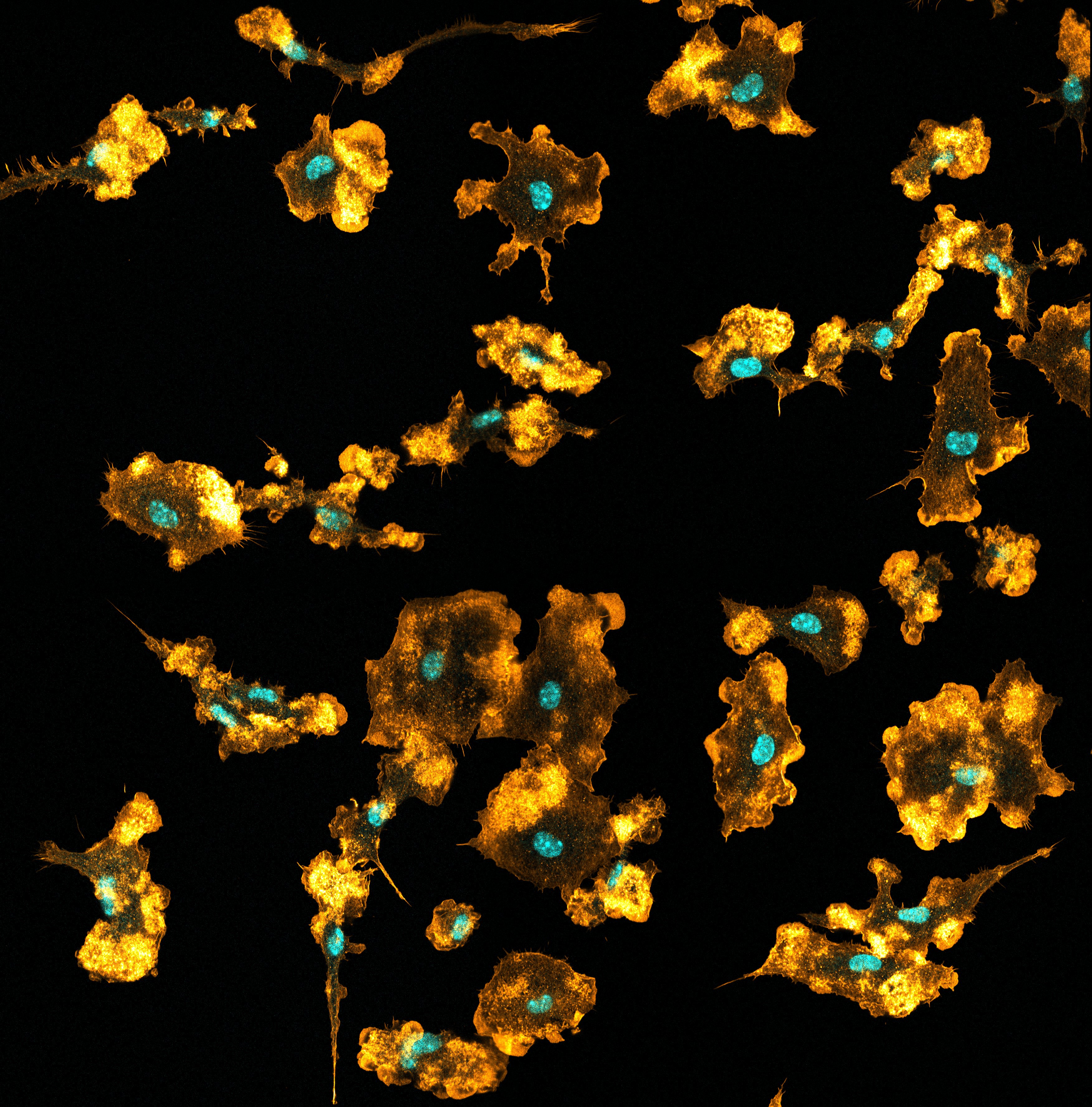 Les macrophages, ces fins gourmets de l’immunité