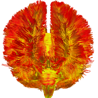 Les macrophages, ces fins gourmets de l’immunité