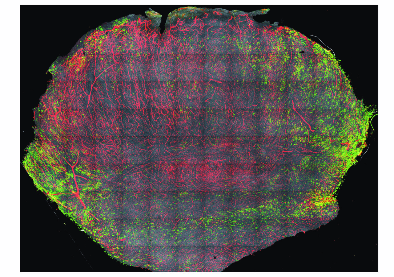 Des hormones sexuelles au cœur d’un nouveau mécanisme pro-métastatique : une avancée majeure pour mieux comprendre et traiter certains cancers