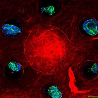 Obésité : le rôle insoupçonné des astrocytes