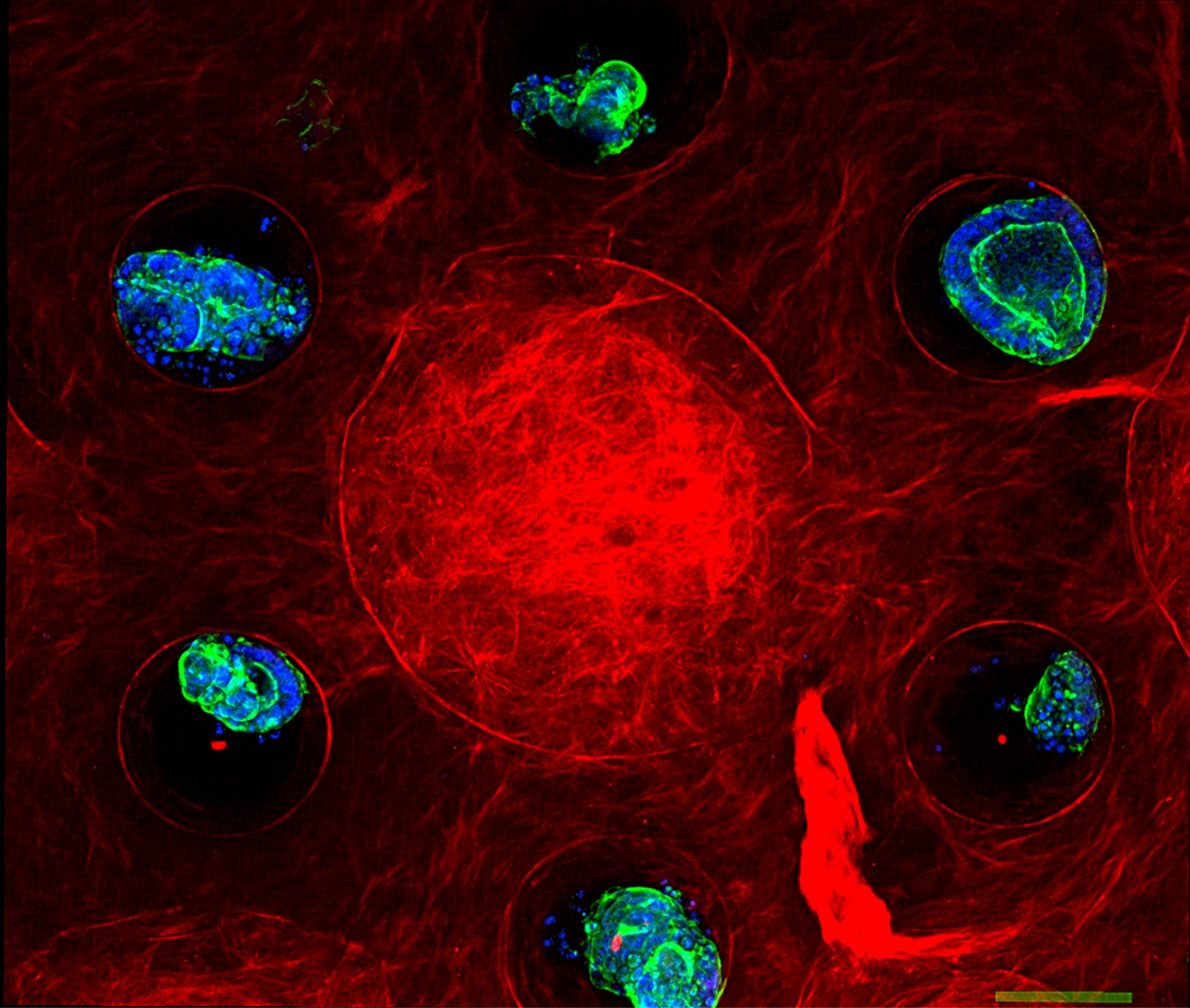 France 2030 - Le CEA, le CNRS et l’Inserm associés pour améliorer le parcours des malades grâce à la bio-ingénierie