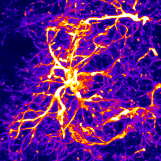 Vieillir en bonne santé : le secret pourrait se trouver dans les cellules de la peau