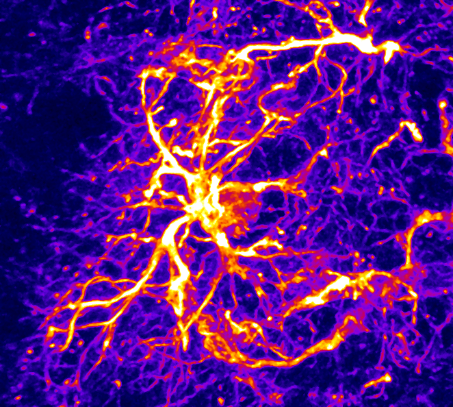 Obésité : le rôle insoupçonné des astrocytes