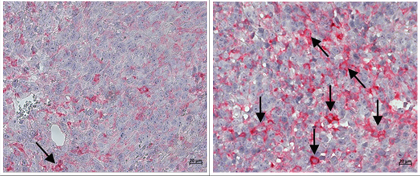 Une nouvelle approche d’immunothérapie pour aider le système immunitaire à détecter les cellules cancéreuses