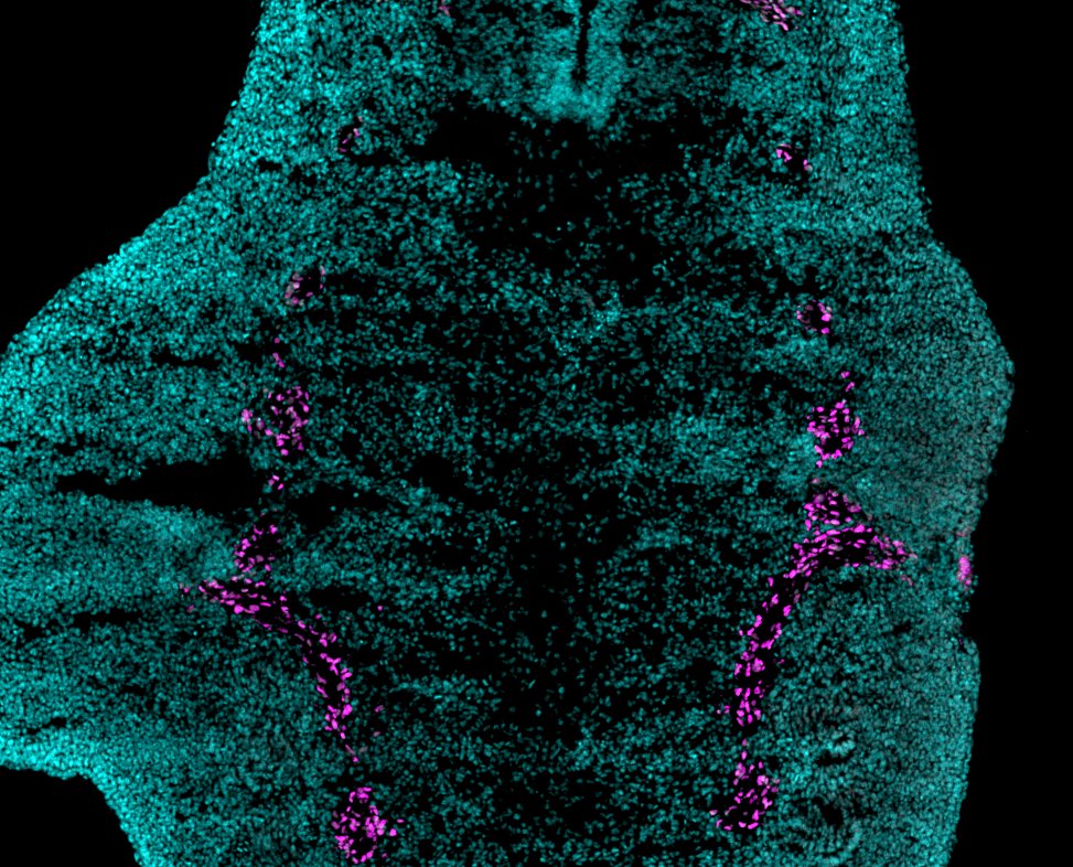 Médecine régénératrice : des scientifiques découvrent les mécanismes grâce auxquels certains vertébrés peuvent faire repousser des membres