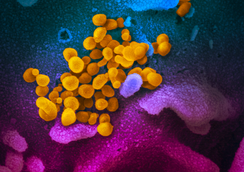RÉVÉLATION CHOC : Ce secret enfin percé va changer la prise en charge du Covid-19 en France !