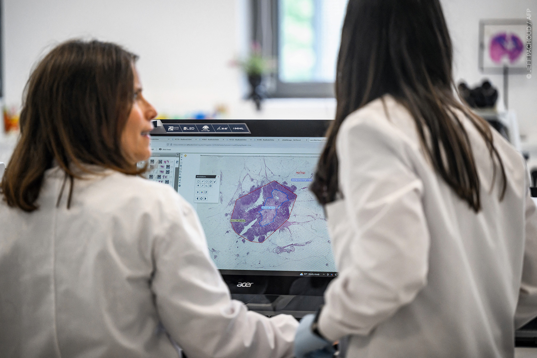 RÉVÉLATION CHOC : Le Parlement européen tire la sonnette d'alarme sur le cancer – Votre santé est en jeu !