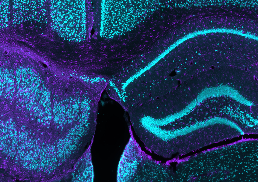 RÉVOLUTION MÉDICALE : Des rayons X pourraient ENFIN libérer les patients de l'épilepsie résistante !