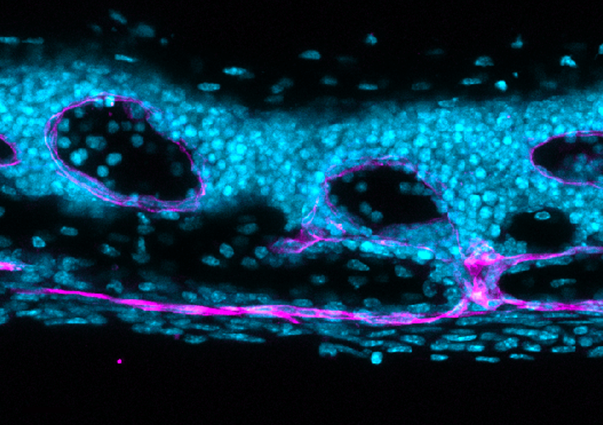 RÉVÉLATION CHOC : Le secret insoupçonné de votre crâne enfin percé pour défendre votre cerveau !