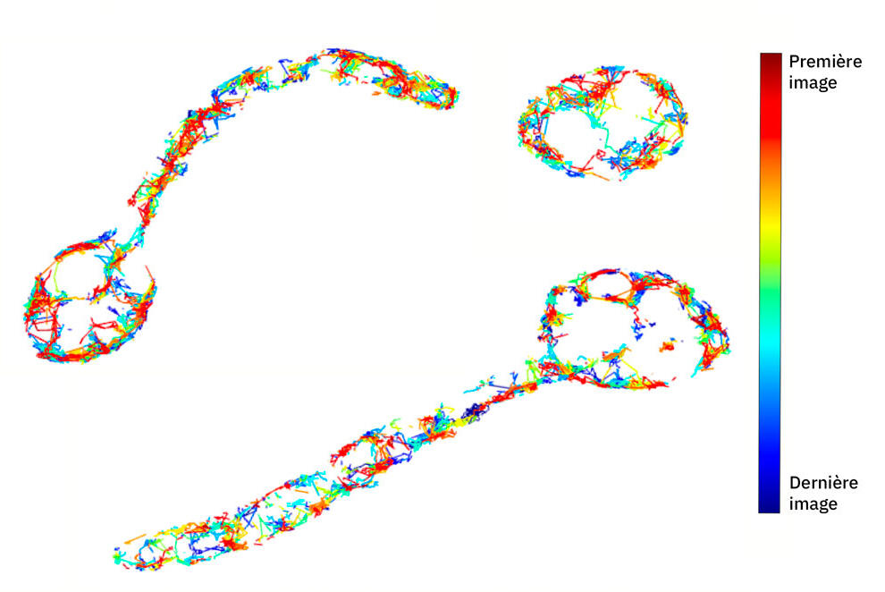 RÉVÉLATION CHOC : Le secret inavouable de la mycose enfin percé par des chercheurs français ! La fin d'un cauchemar ?