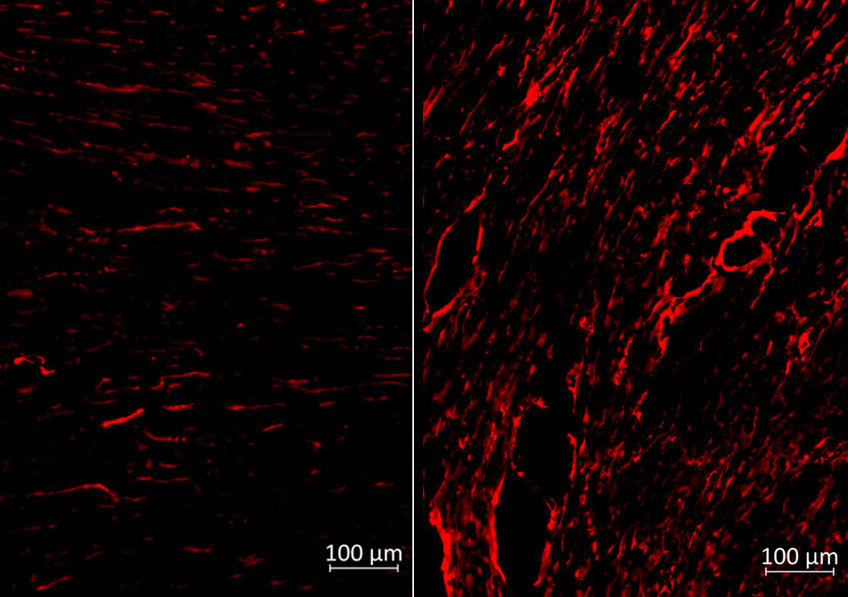 « La tolérance aux maladies » : une nouvelle stratégie de défense activée par les vaccins à ARNm révélée