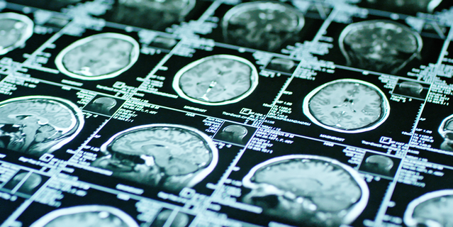 LA VÉRITÉ CHOC SUR INTERNET : CE QUE LES ALGORITHMES VOUS CACHENT ET COMMENT LA SCIENCE LUTTE POUR VOUS SAUVER !