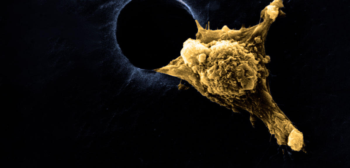 Le secret des cellules baladeuses