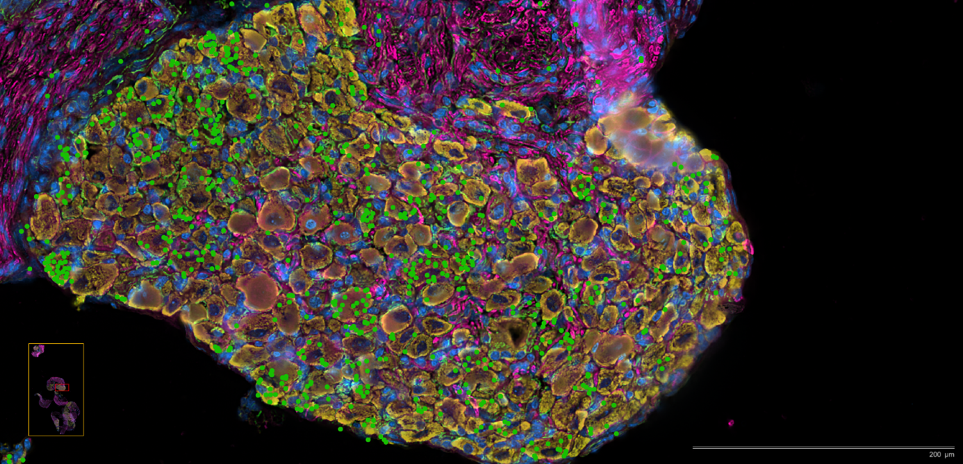 Démangeaisons et inflammation de la peau : l'implication étonnante de nos neurones